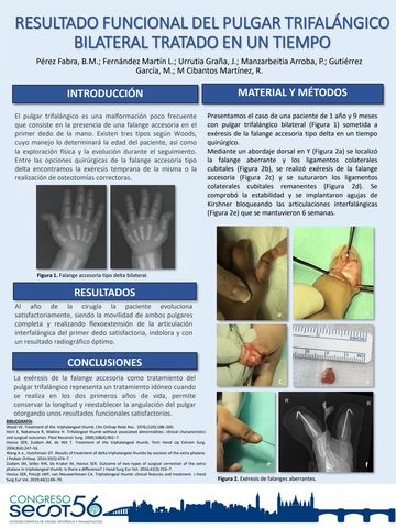 Síndrome del túnel carpiano  Traumatólogo Dr. Manuel Molna