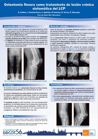 Rotura de Ligamento Cruzado Anterior - Juan Arnal: Traumatologo en Madrid