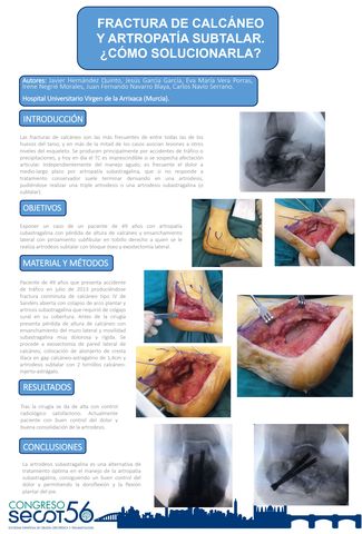 Fascitis Plantar - Mucho más - DR CARRILLO PIÑERO